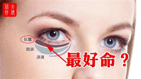 臥蠶上有痣|「臉痣」看健康、運勢！專家解析10種痣：眼下這顆痣。